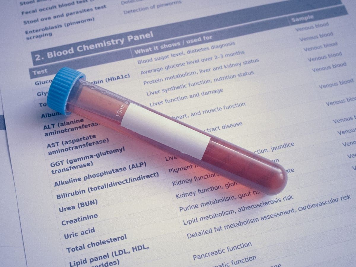 A blood sample tube resting on a printed blood chemistry results form