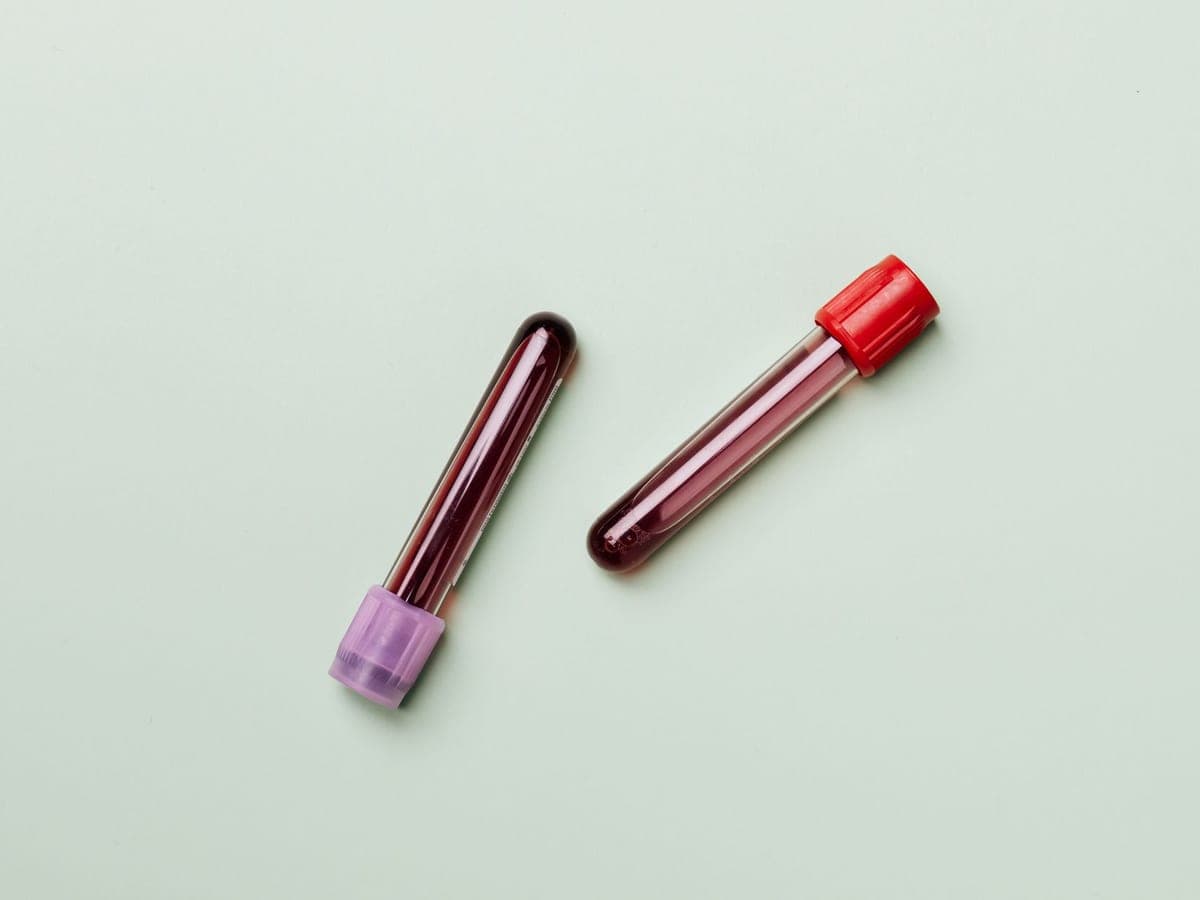 Two blood sample tubes on a plain pale background