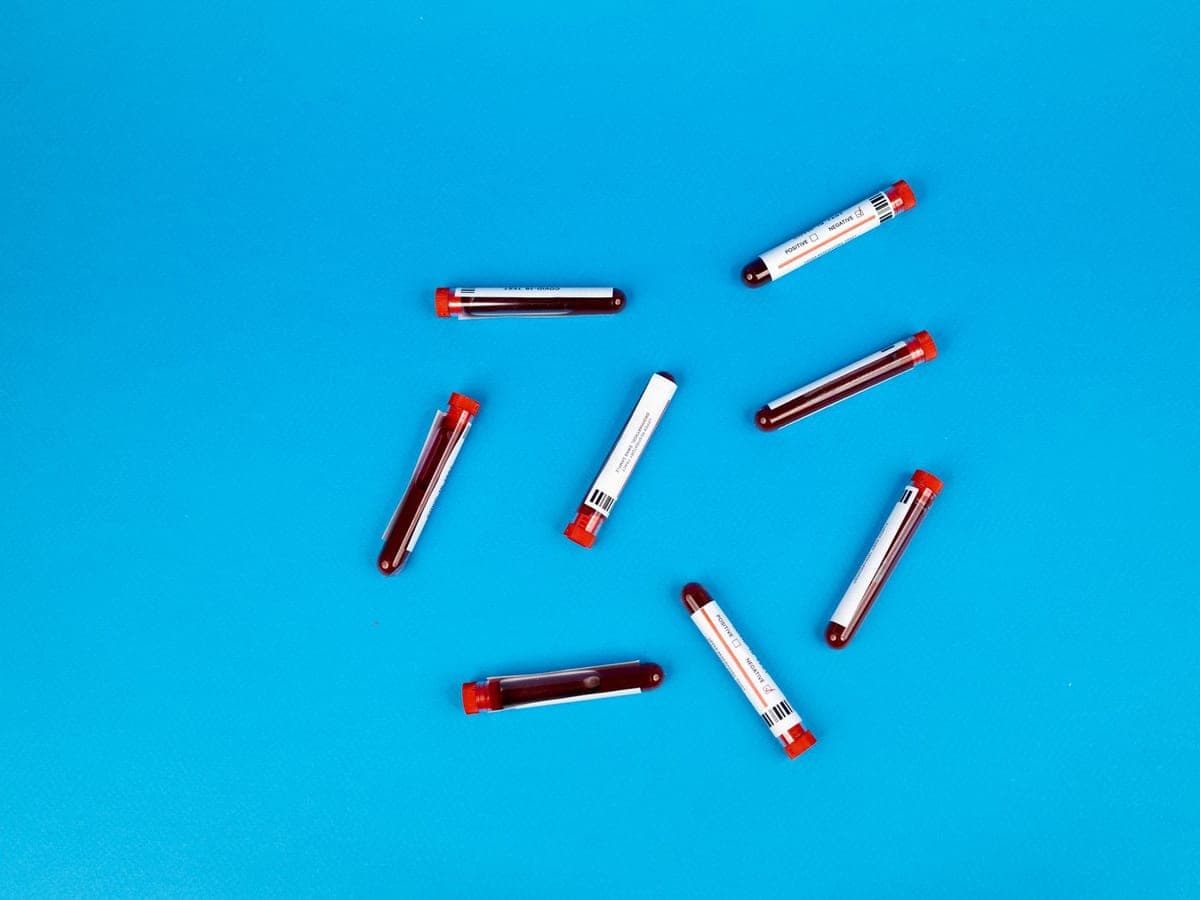 Blood sample tubes laid out on a bright blue background