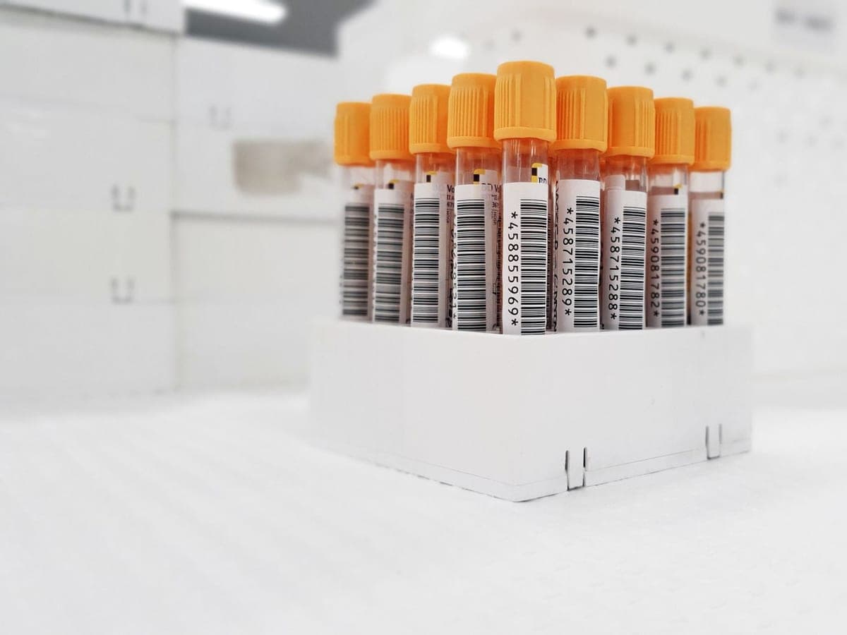 A full rack of capped blood sample tubes on a laboratory bench