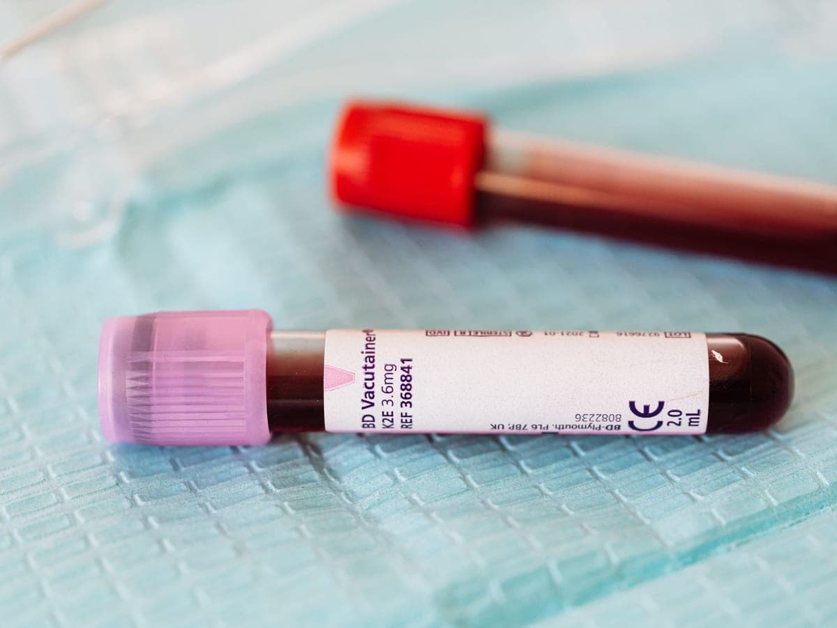 A single labelled blood sample tube on a clinical drape